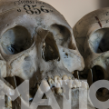 0001 — exHumations